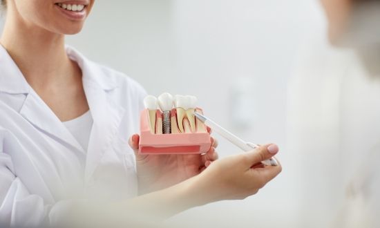 Dentist showing a dental implant model to a patient