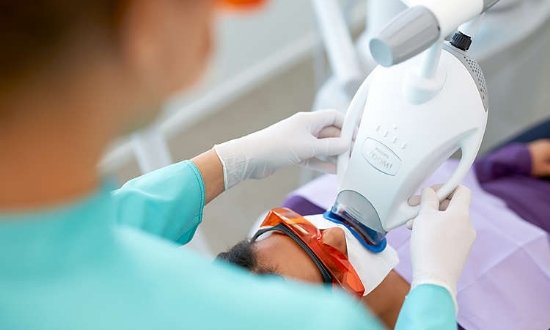 Dental patient having their teeth professionally whitened