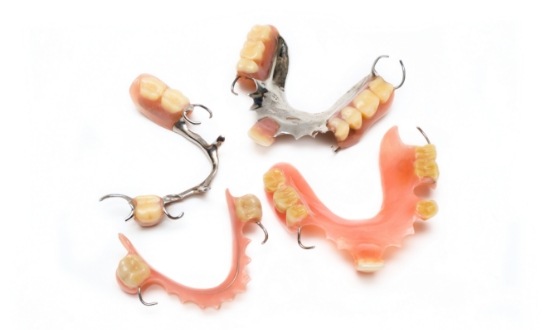 Four partial dentures against white background