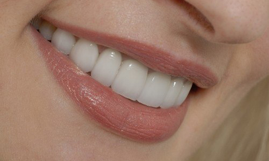 CLose up of smiling blonde woman with flawless teeth